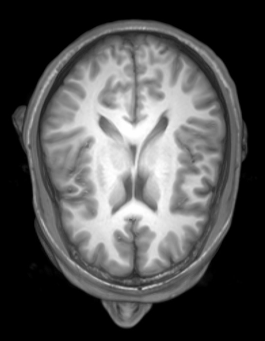 COM Neuroanatomy Secured Material