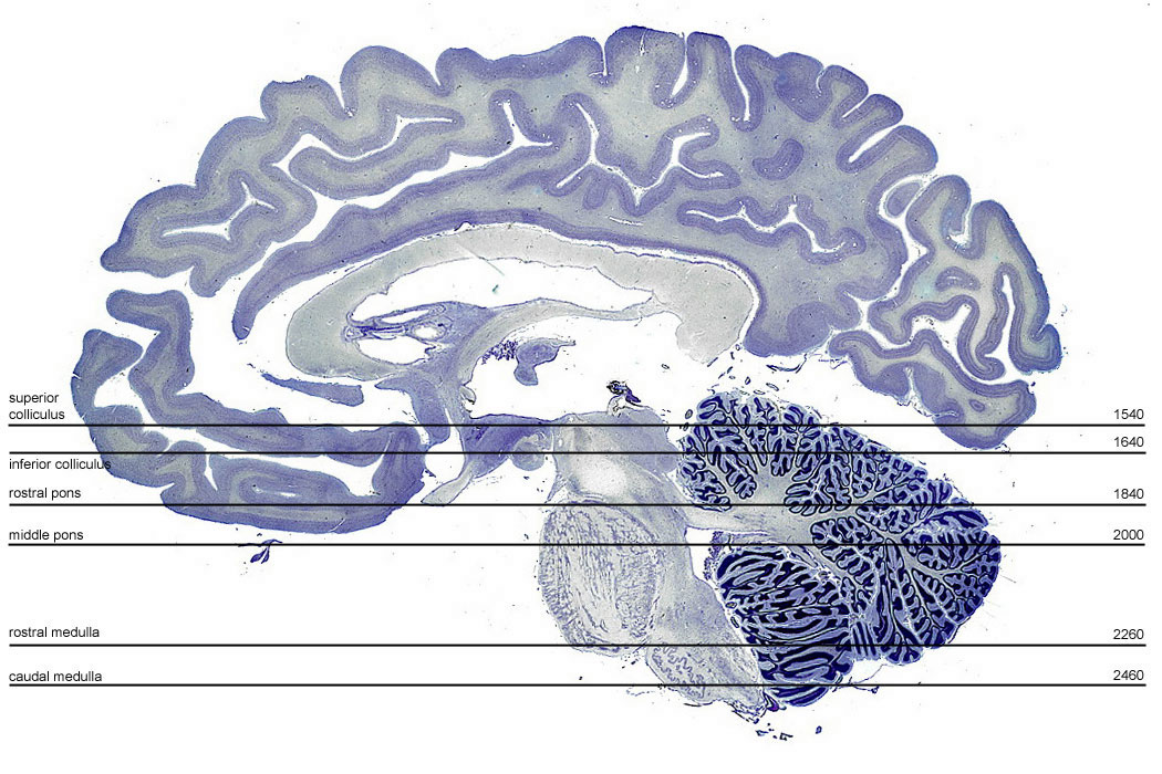 Atlas of the Human Brain Stem - Selection and Level Selector