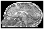 Sagittal Plane