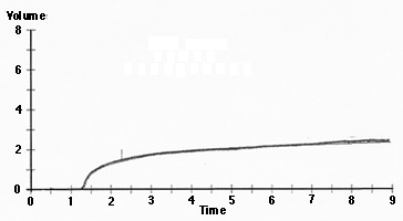 Mild Obstruction Volume Time Curve