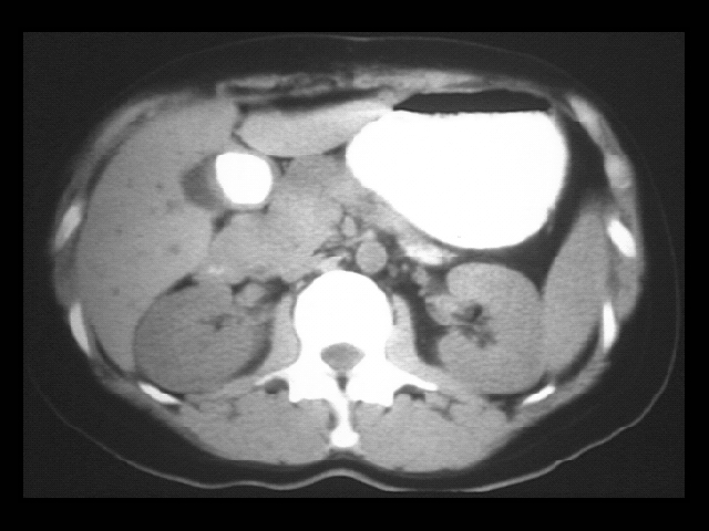 slide 39