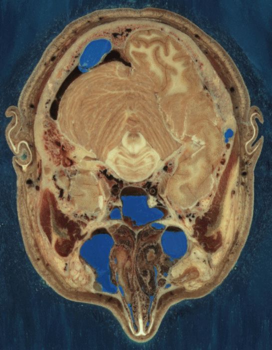 CHM Neuroanatomy Secured Material