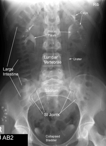 Anatomy Radiologic Images